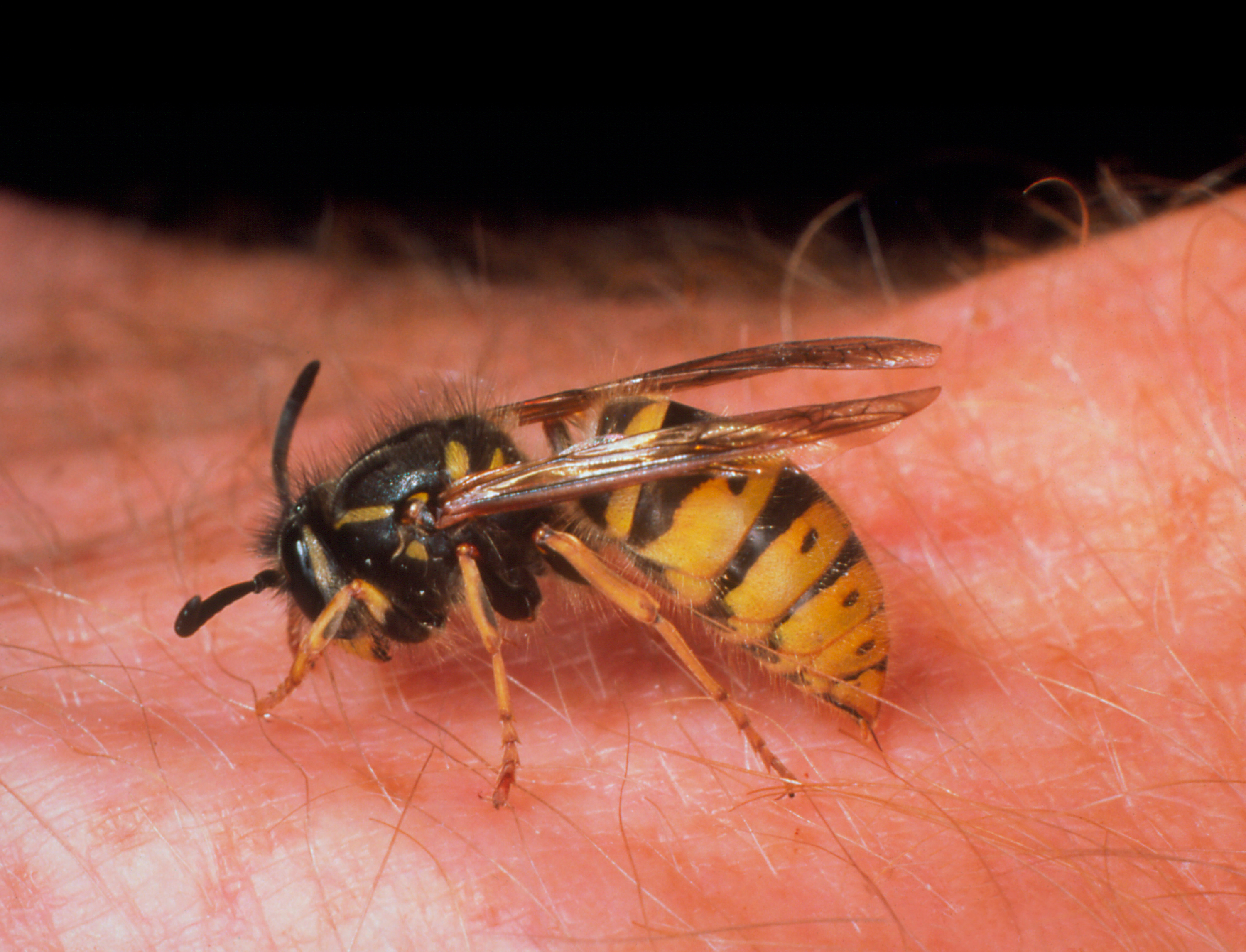 Wasp stinging