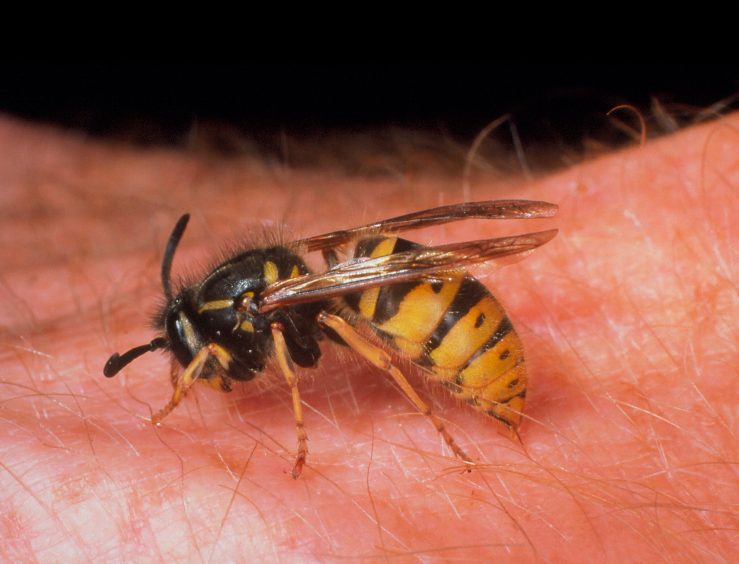 Wasp stinging