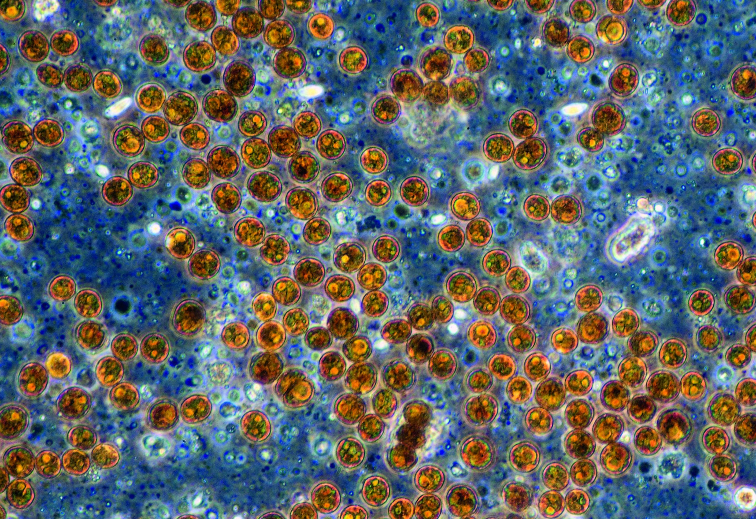 Microscopic photo of symbiotic algae (Zooxanthellae) of the dinoflagellat genus Symbiodinium (syn.: Gymnodinium). Sampled from a soft coral (Sinularia spec.)